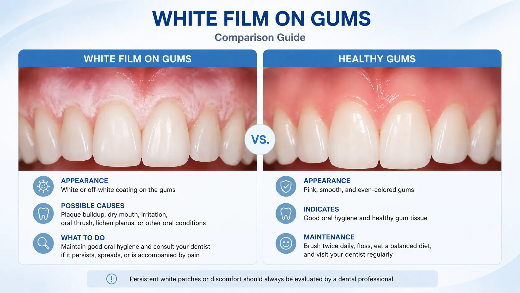White film on gums compared with healthy gums