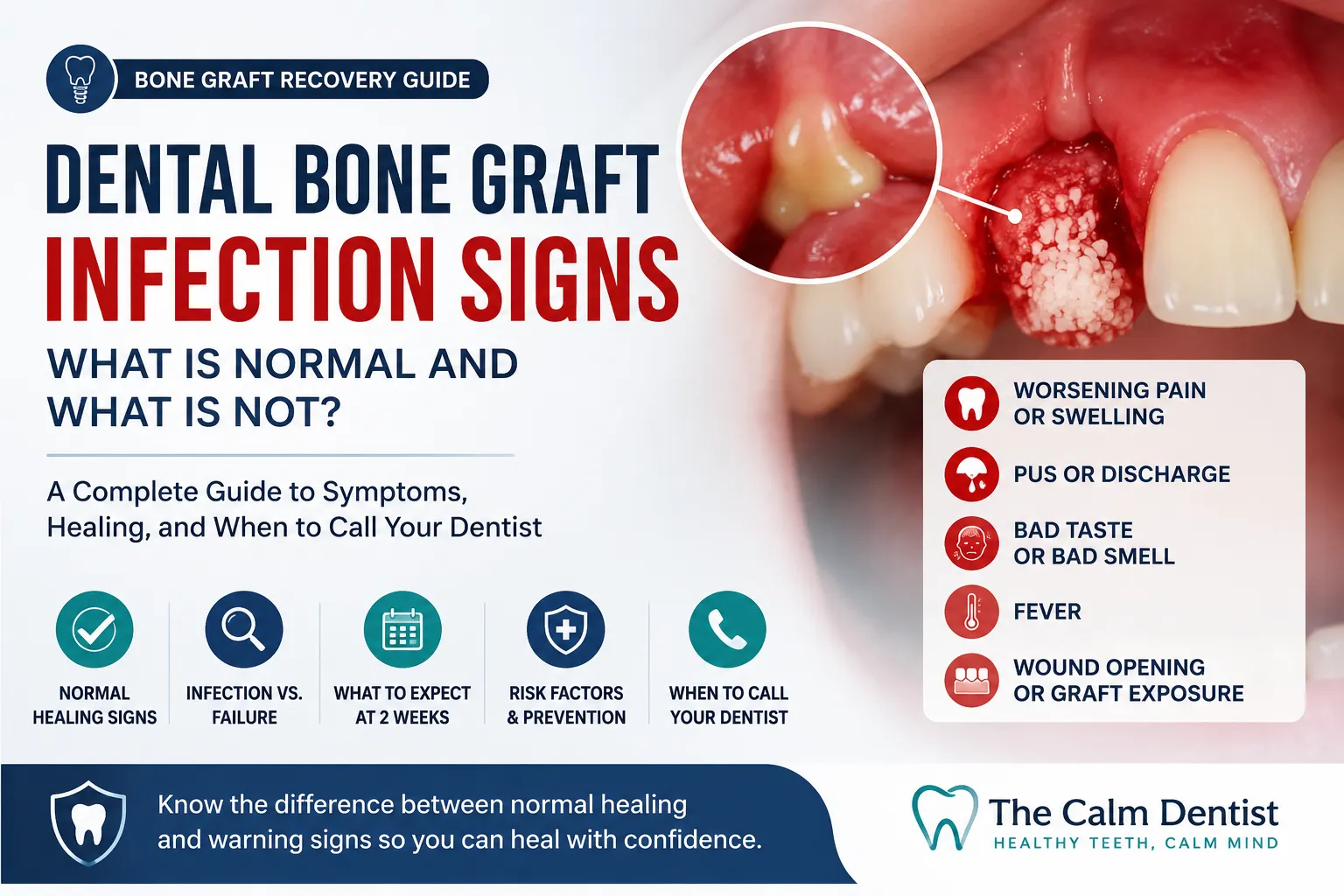 dental-bone-graft-infection-signs