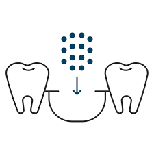 Dental Bone Grafts