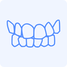 Dental Bite and Occlusion 