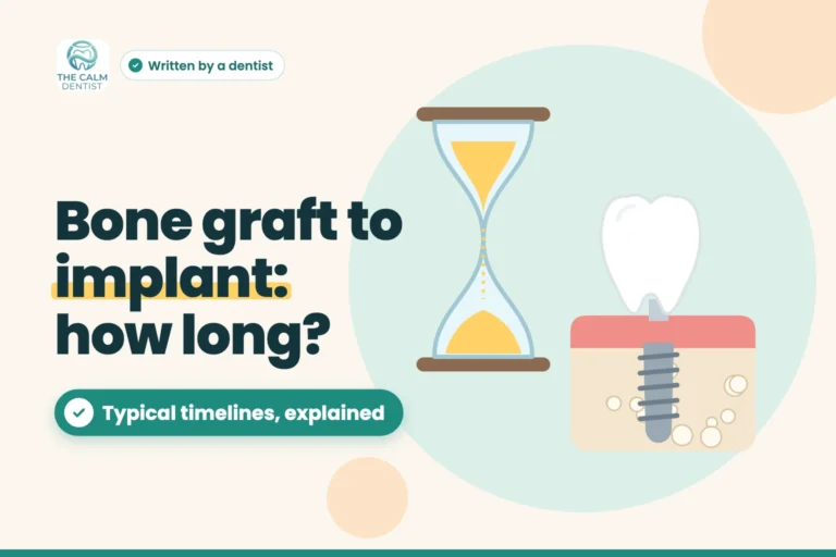 Illustration of an hourglass beside a dental implant in healed bone, titled Bone graft to implant: how long?