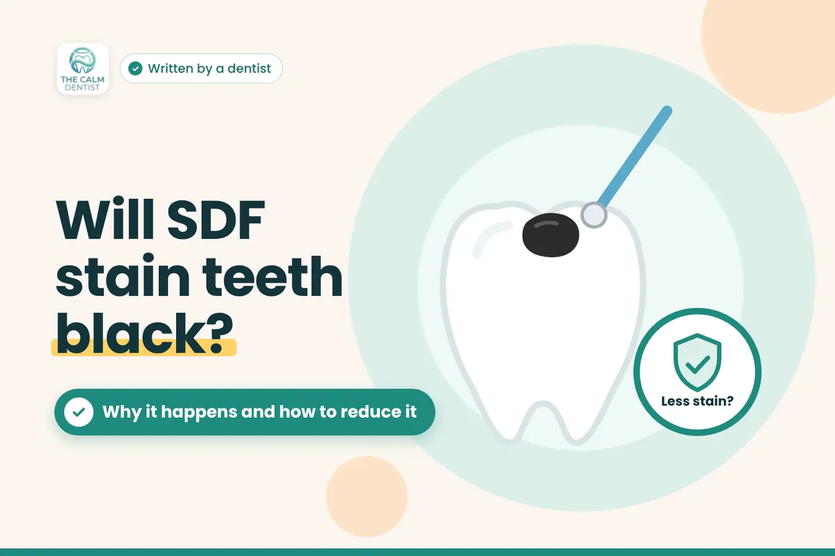 Silver Diamine Fluoride (SDF): Does It Stain Teeth Black? A Dentist-Researcher Explains